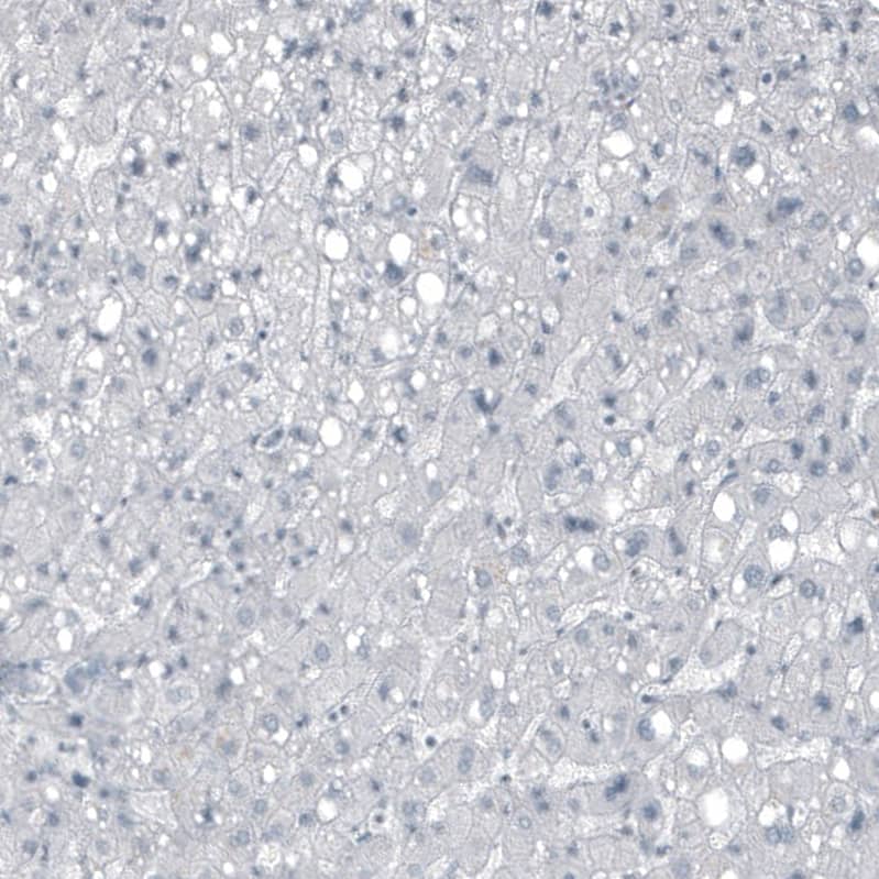 Staining of human liver shows no positivity in hepatocytes as expected.