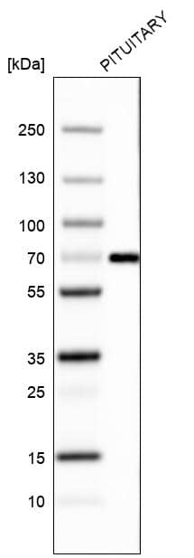 Analysis in human pituitary gland tissue.