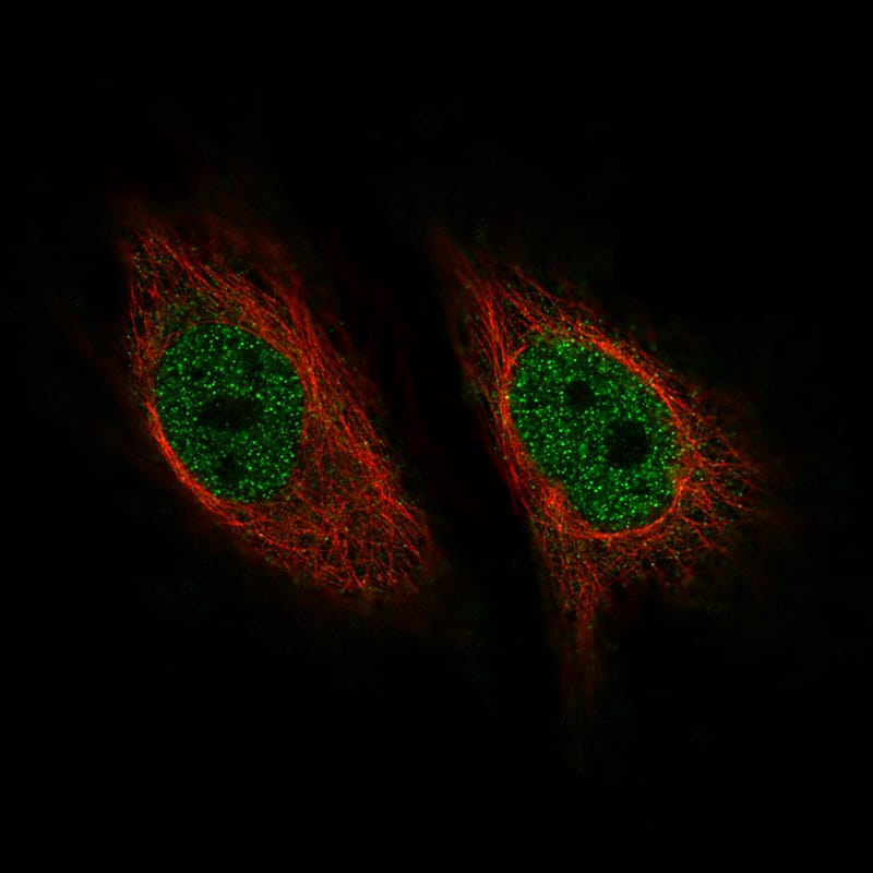 Staining of HeLa cells using the Anti-ZNF10 monoclonal antibody) . 