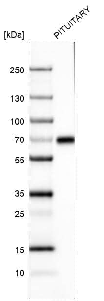 Analysis in human pituitary gland tissue.