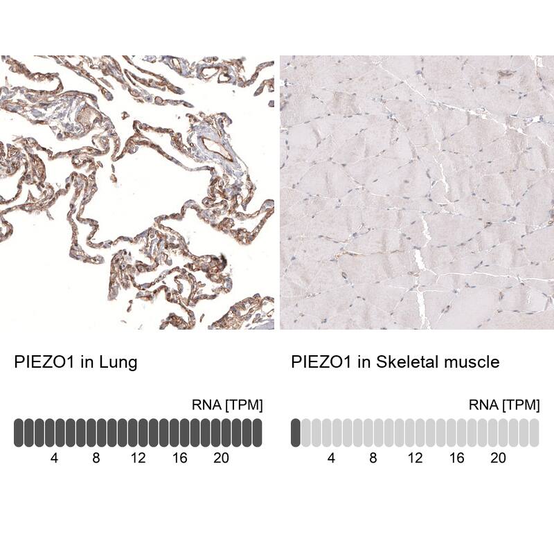 Analysis in human lung and skeletal muscle tissues using NBP3-44234 antibody. Corresponding PIEZO1 RNA-seq data are presented for the same tissues.