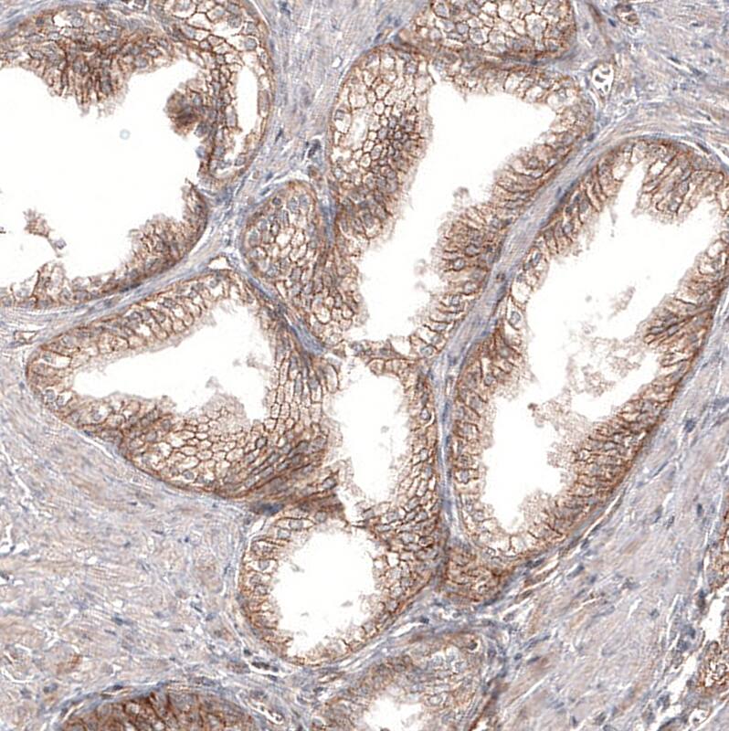 Staining of human prostate shows moderate membranous positivity in glandular cells.