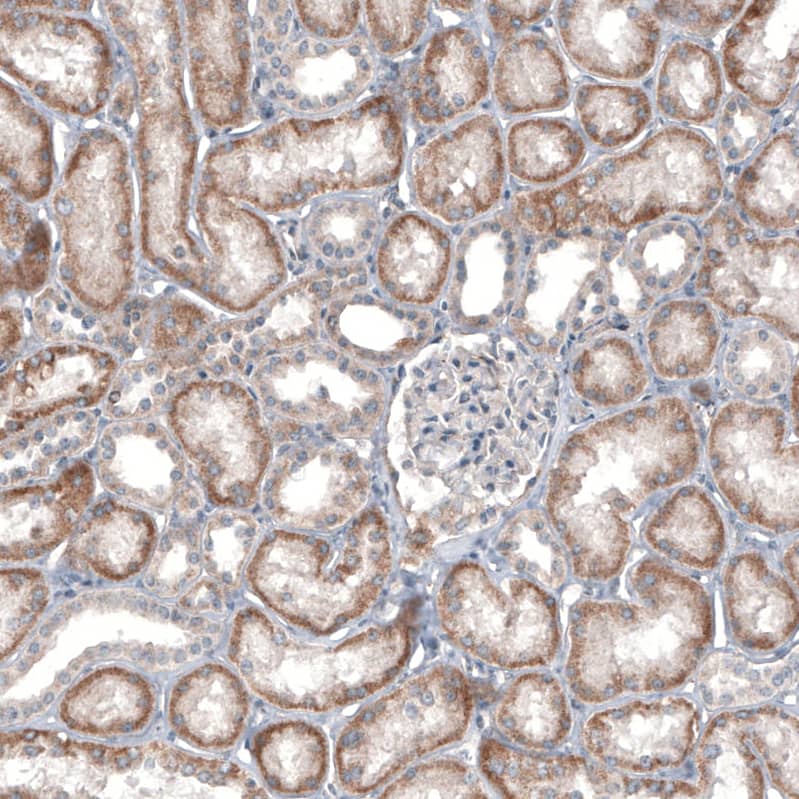 Staining of human kidney shows no positivity in cells in glomeruli.