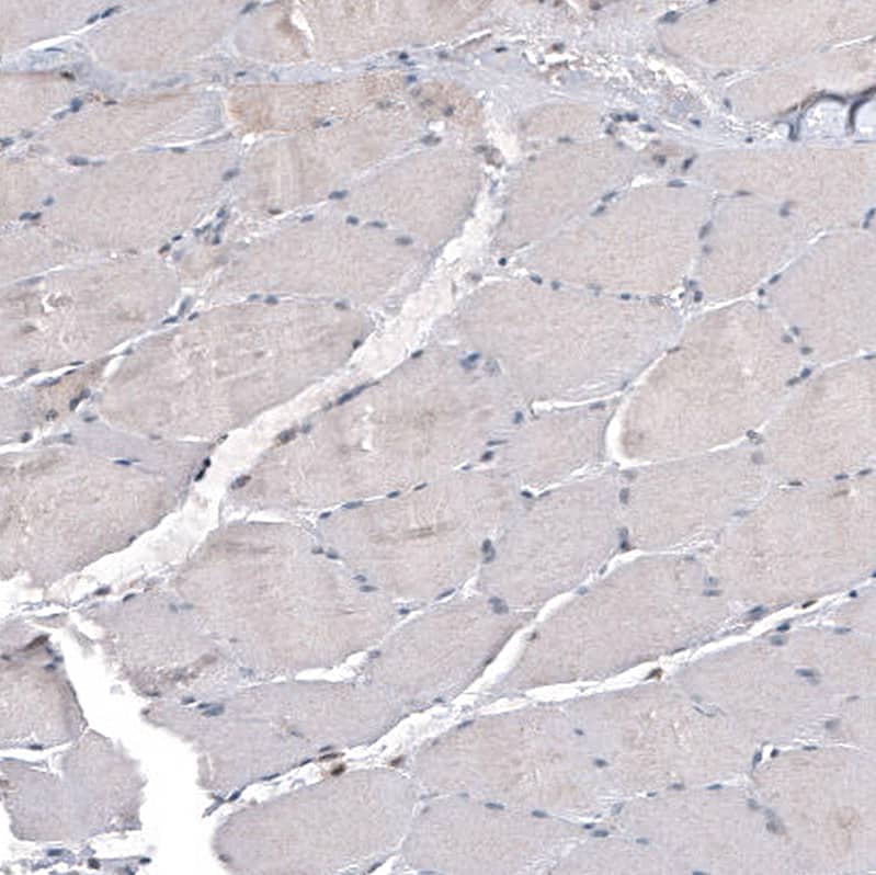 Staining of human skeletal muscle shows low positivity in myocytes as expected.