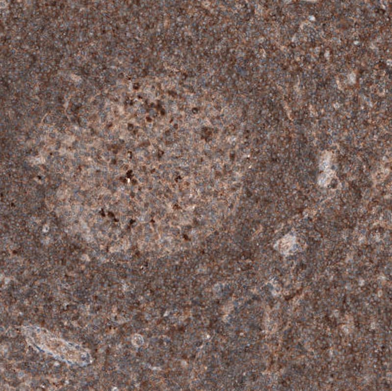 Staining of human lymph node shows moderate to strong cytoplasmic positivity in non-germinal center cells.