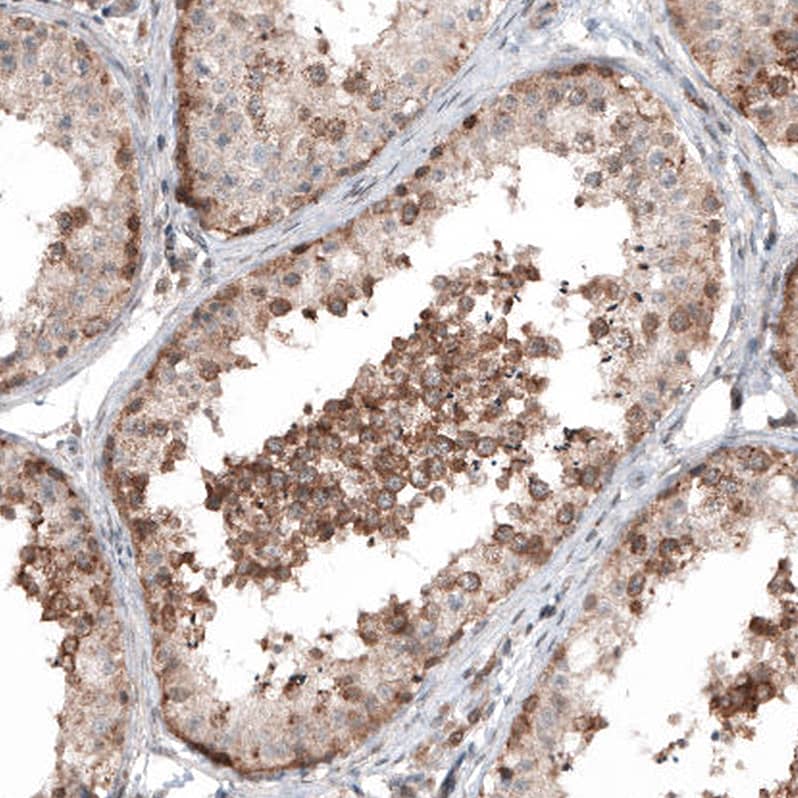 Staining of human testis shows moderate cytoplasmic positivity in cells in seminiferous ducts.