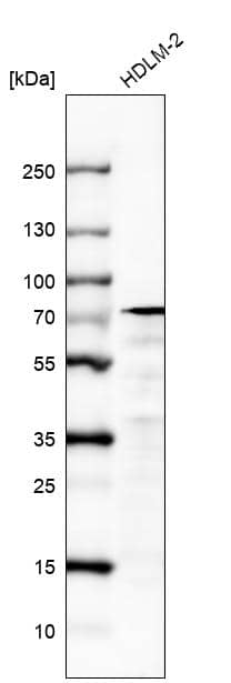 Analysis in human cell line HDLM-2.