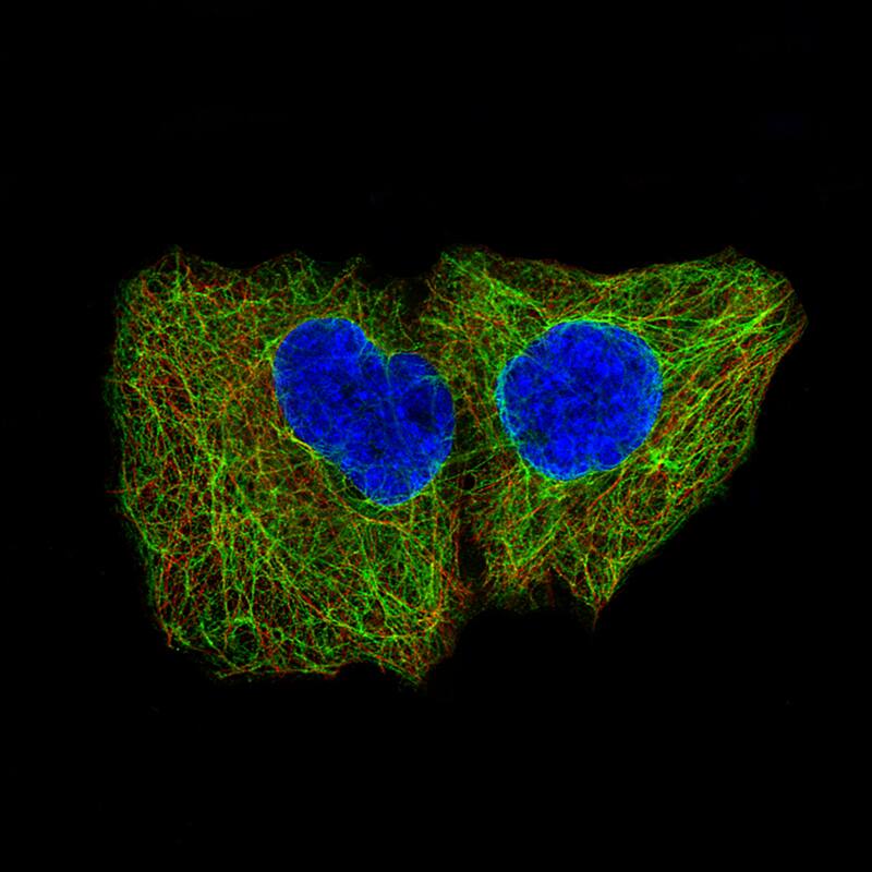 Staining of A-431 cells, showing specific staining in intermediate filaments in green. Microtubule- and nuclear probes are visualized in red and blue, respectively (where available).