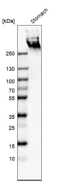Analysis in human stomach tissue.