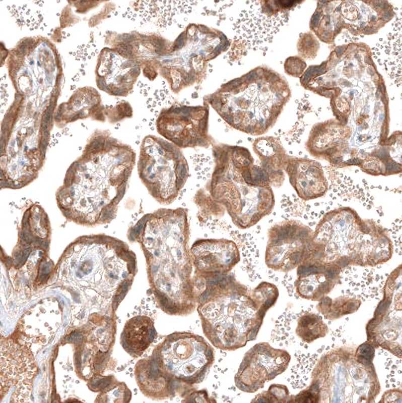 Staining of human placenta shows moderate cytoplasmic positivity in trophoblastic cells.