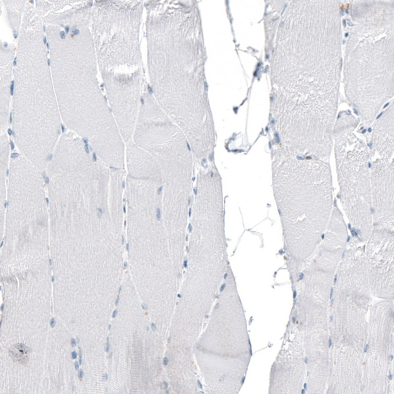 Staining of human skeletal muscle shows no positivity in myocytes as expected.