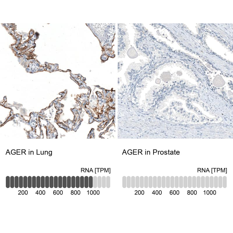 Analysis in human lung and prostate tissues using NBP3-44242 antibody. Corresponding AGER RNA-seq data are presented for the same tissues.