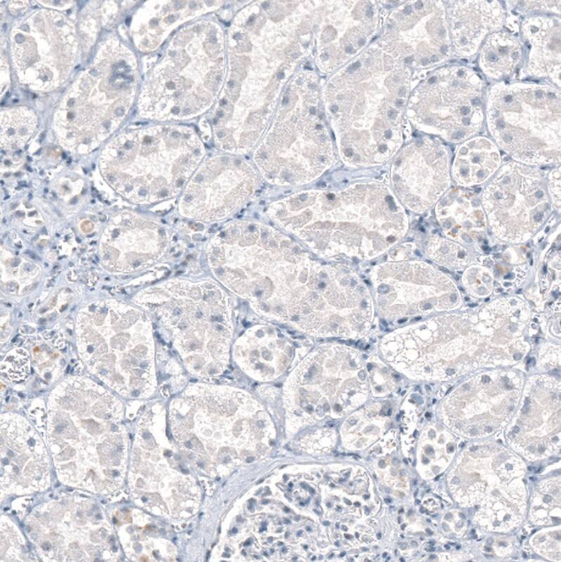 Staining of human kidney shows no positivity in cells in tubules as expected.