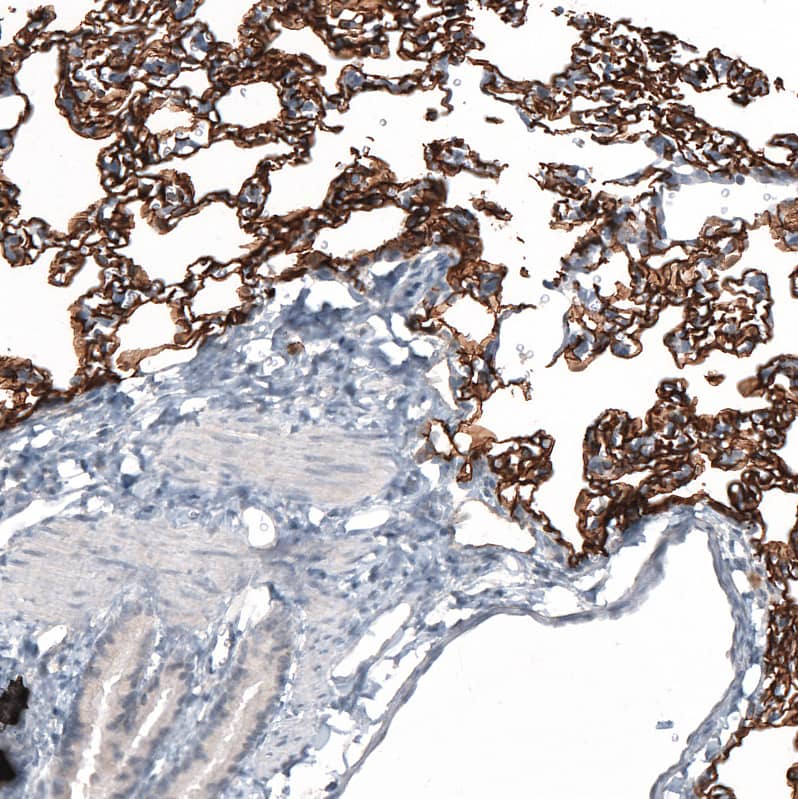 Staining of rat lung shows strong membranous positivity in pneumocytes.