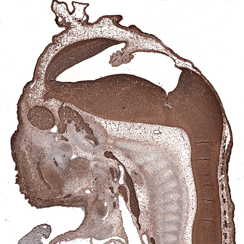 Staining of mouse embryo E11 shows strong positivity in the developing central and peripheral nervous system.