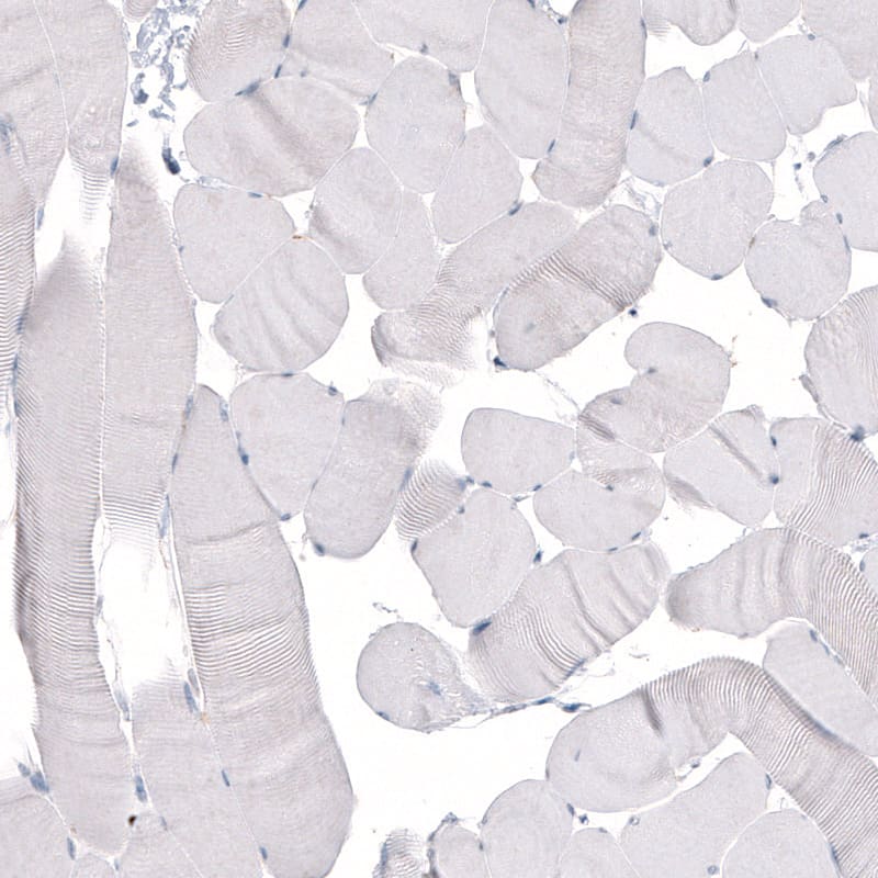 Staining of human skeletal muscle shows absence of positivity in striated muscle fibers as expected (negative control).