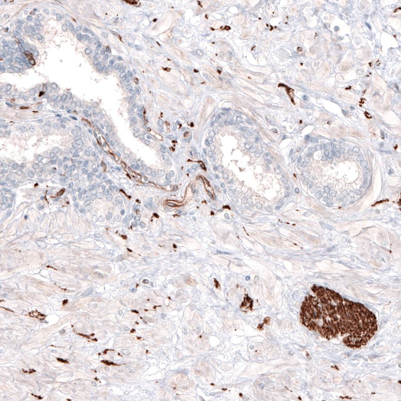 Staining of human prostate shows strong positivity in the peripheral nerves.