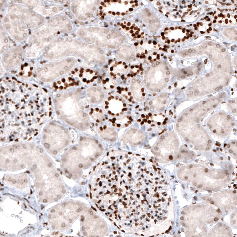 Staining of human kidney shows strong nuclear positivity in cells in renal glomeruli and a subset of renal tubules.