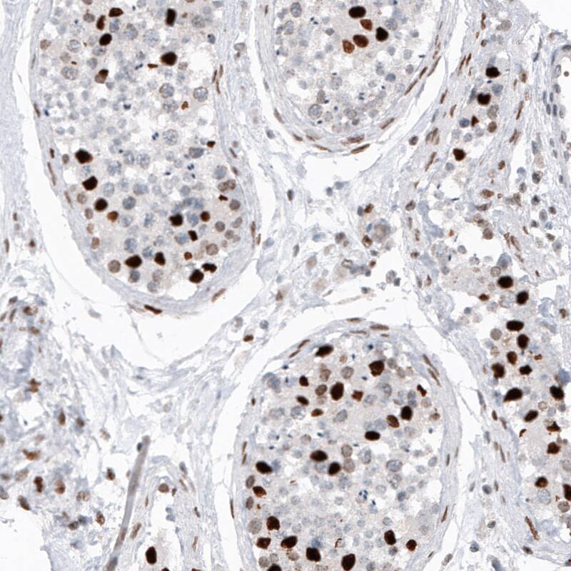 Staining of human testis shows strong nuclear immunoreactivity in a subset of cells in seminiferous tubules.