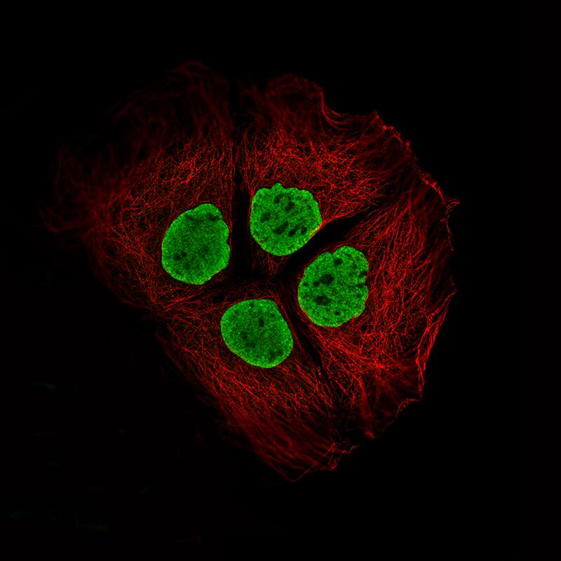 Staining of CACO-2 cells using the Anti-Histone H2AY/macroH2A.1 monoclonal antibody) .