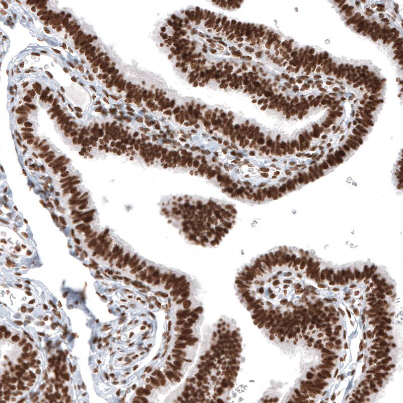 Staining of human fallopian tube shows strong nuclear positivity in glandular and stromal cells.