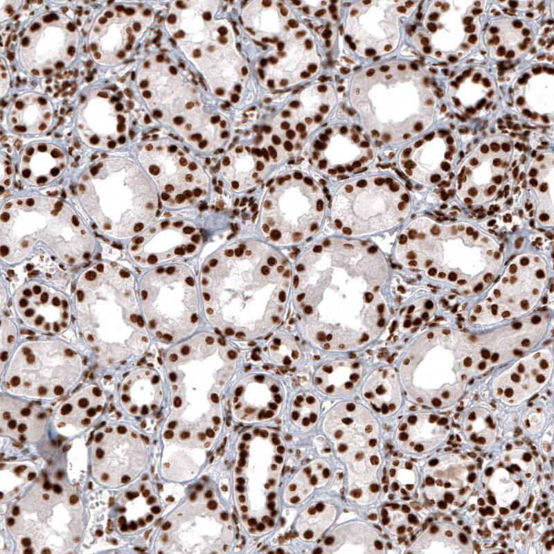 Staining of human kidney shows strong nuclear positivity in renal tubules cells.