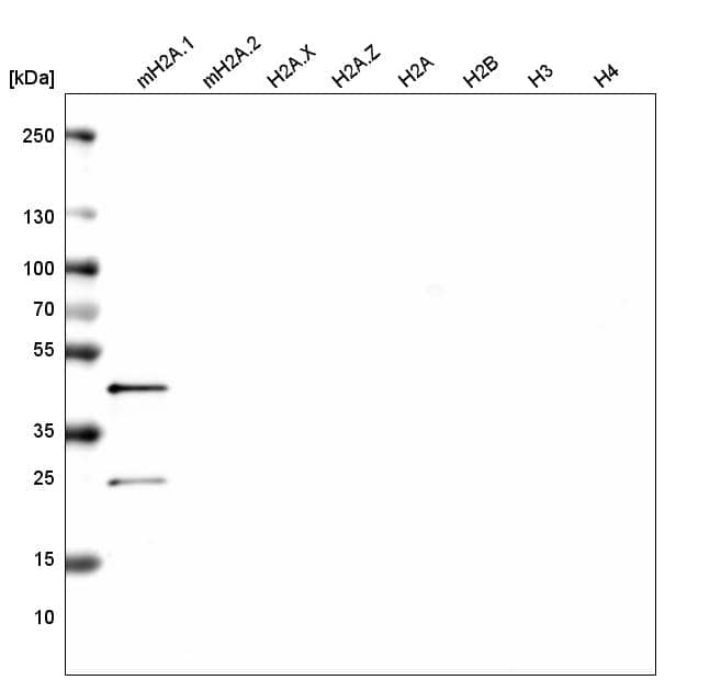 Analysis of purified human recombinant histone mH2A.1, mH2A.2, H2A.X, H2A.Z, H2A, H2B, H3 and H4.