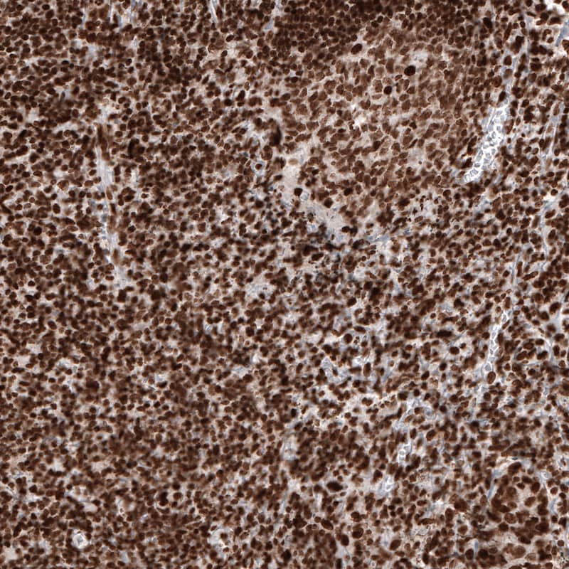 Staining of human tonsil shows strong nuclear immunoreactivity in lymphoid cells.