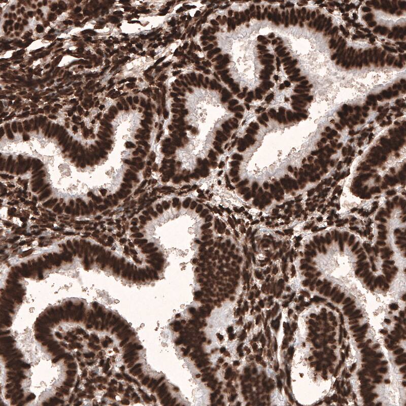 Staining of human endometrium shows strong nuclear positivity in glandular and stromal cells.