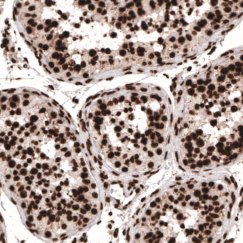 Staining of human testis shows strong nuclear positivity in cells in seminiferous tubules.