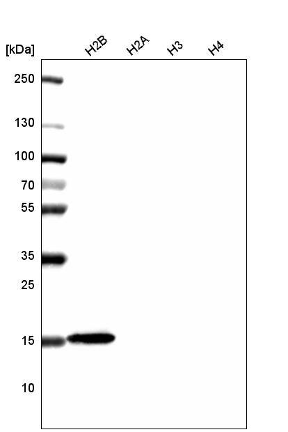 Analysis of purified human recombinant histone H2B, H2A, H3 and H4.