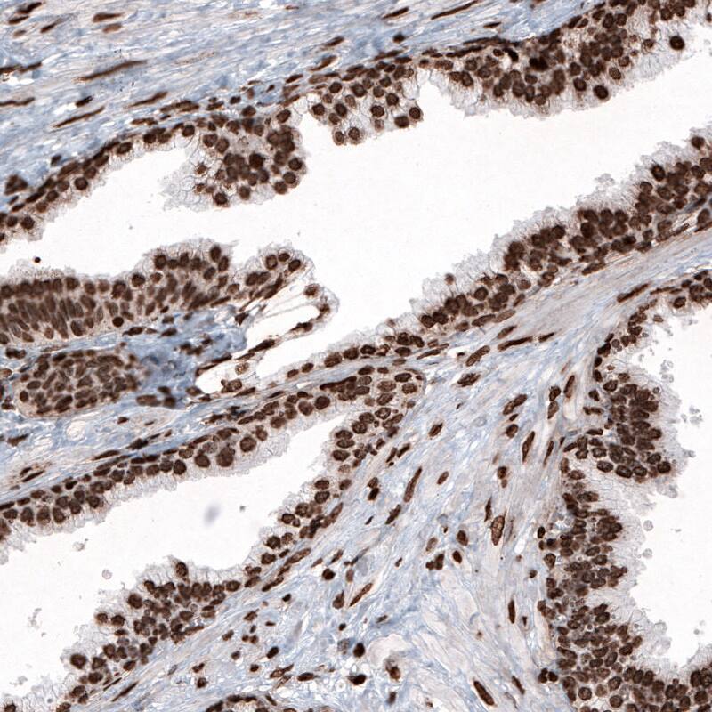 Staining of human prostate shows strong nuclear immunoreactivity in glandular and smooth muscle cells.