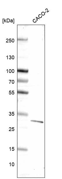 Analysis in human cell line CACO-2.