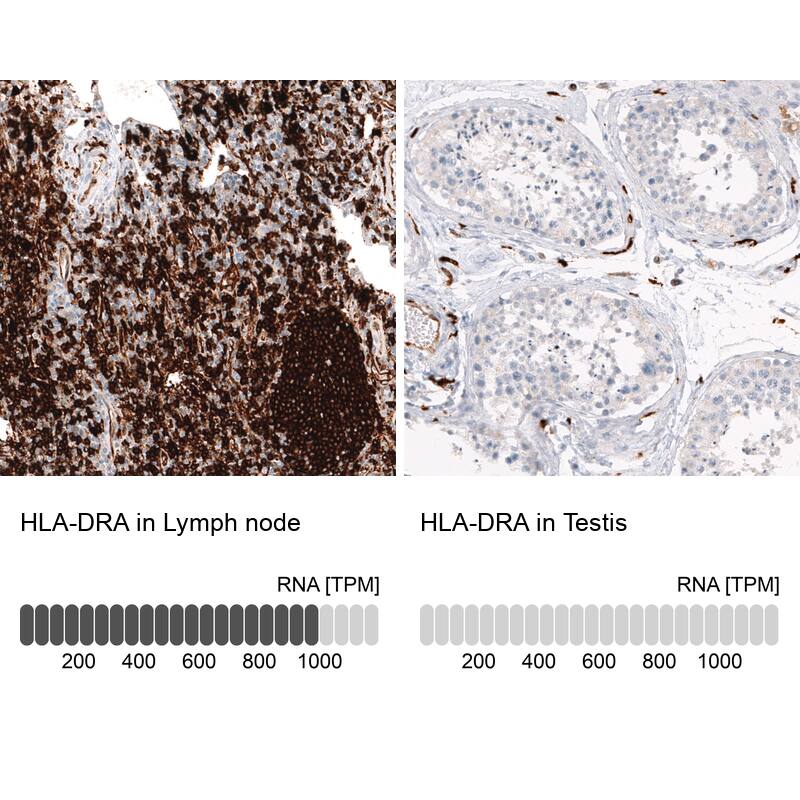 Analysis in human lymph node and testis tissues using NBP3-44261 antibody. Corresponding HLA DR/DP RNA-seq data are presented for the same tissues.