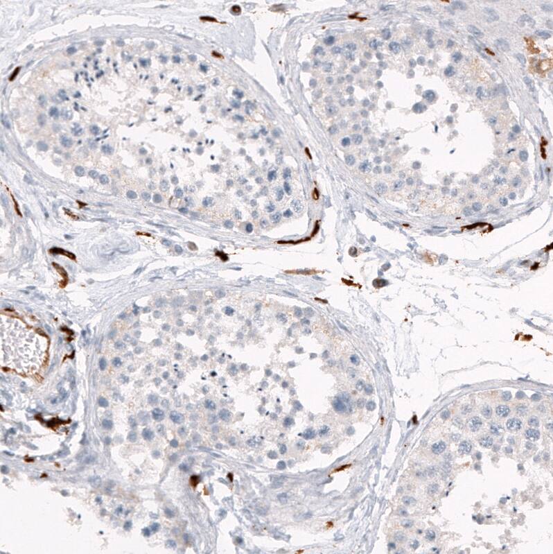 Staining of human testis shows no positivity in cells in seminiferous ducts as expected.