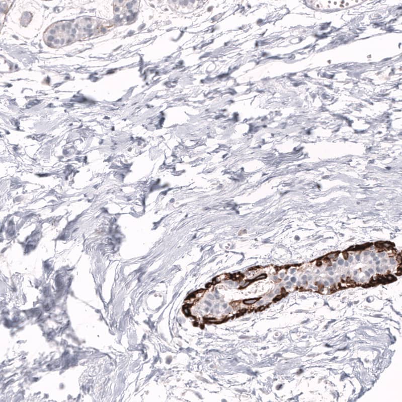 Staining of human breast shows strong cytoplasmic positivity in basal layer of ductal cells.