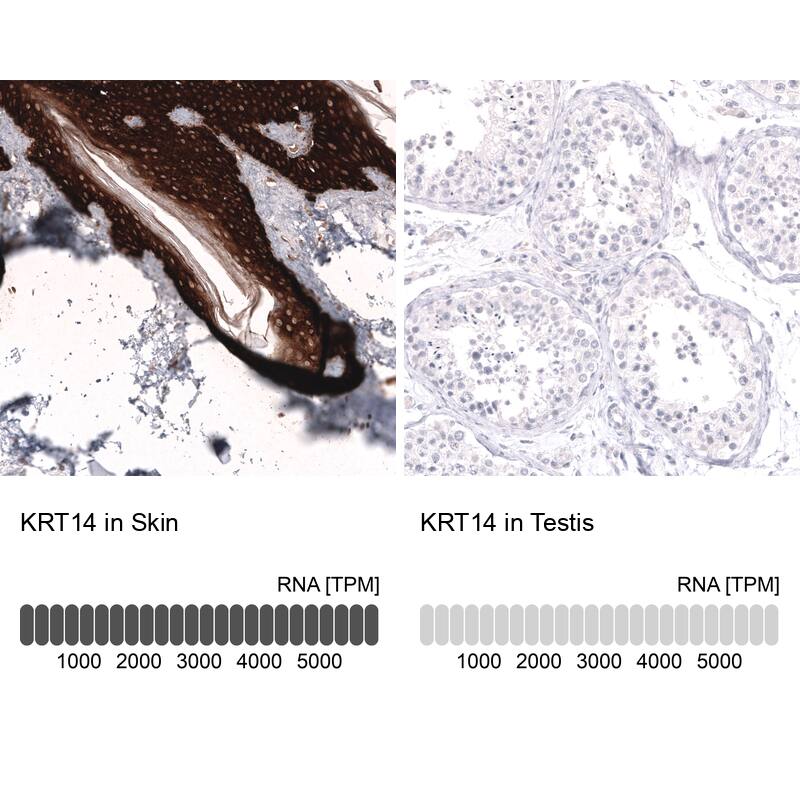 Analysis in human skin and testis tissues using NBP3-44264 antibody. Corresponding Cytokeratin 14 RNA-seq data are presented for the same tissues.