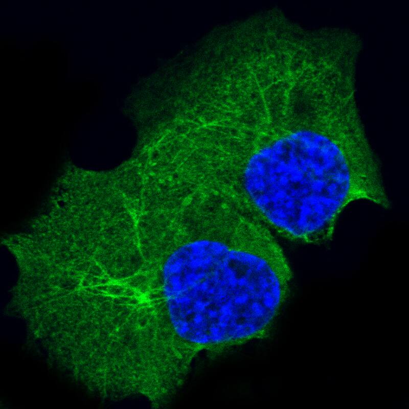 Staining in A-431 cell line with Anti-Cytokeratin 14 monoclonal antibody) .