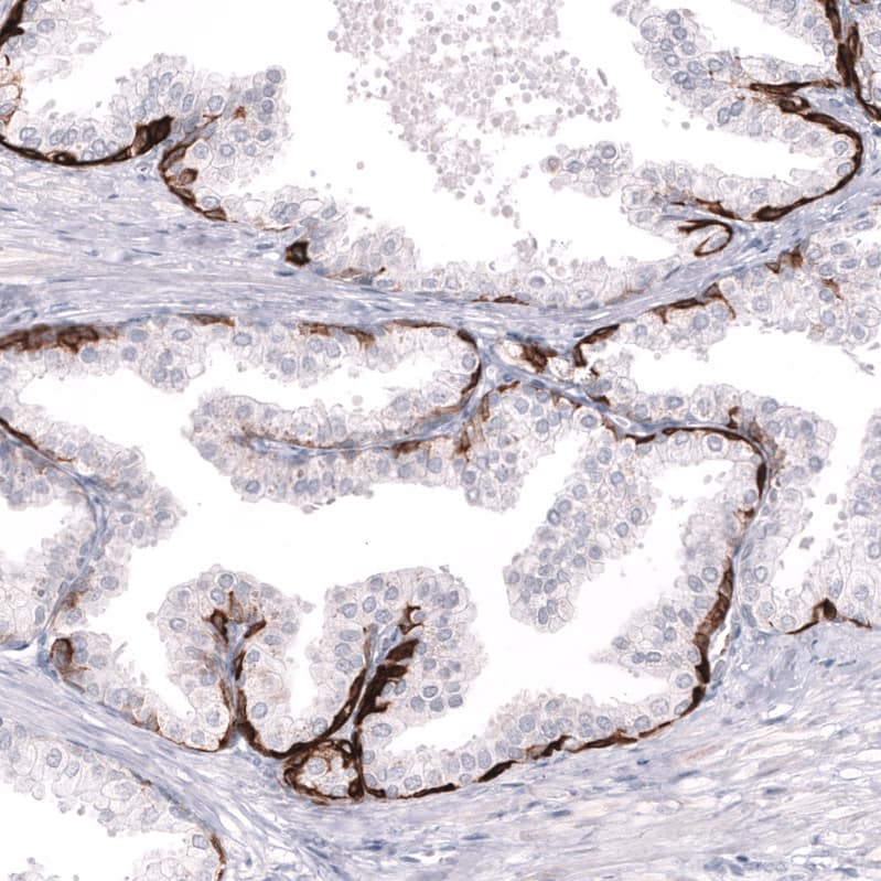 Staining of human prostate shows strong cytoplasmic positivity in basal layer of glandular cells.