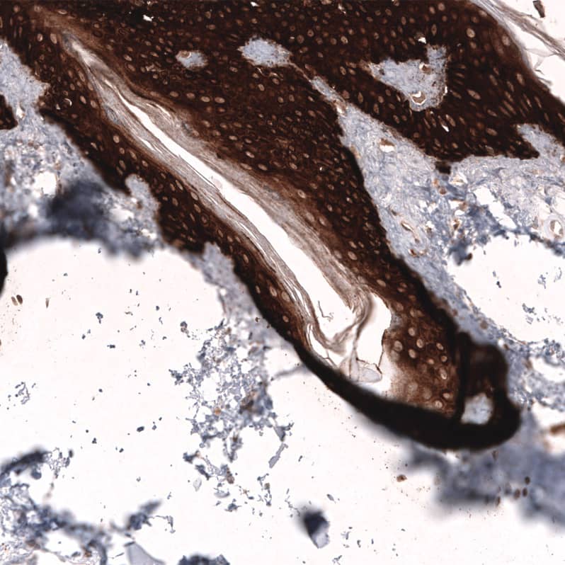 Staining of human skin shows strong cytoplasmic positivity in squamous epithelial cells.
