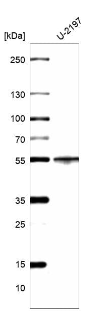 Analysis in human cell line U-2197.