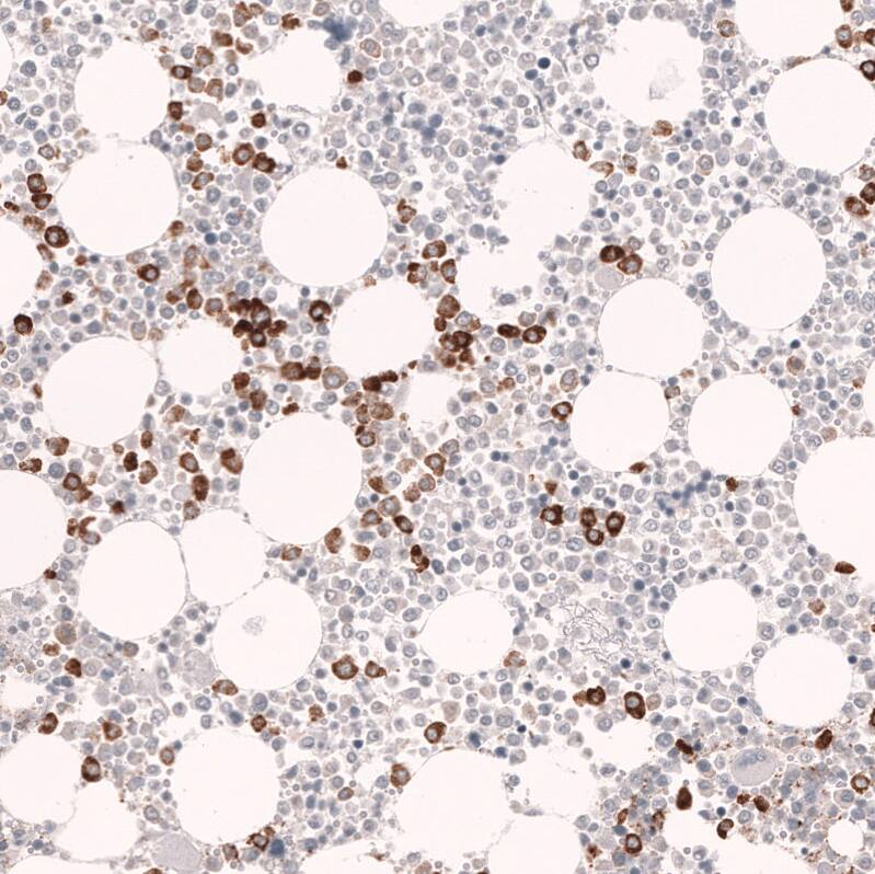 Staining of human bone marrow shows strong cytoplasmic positivity in hematopoietic cells.