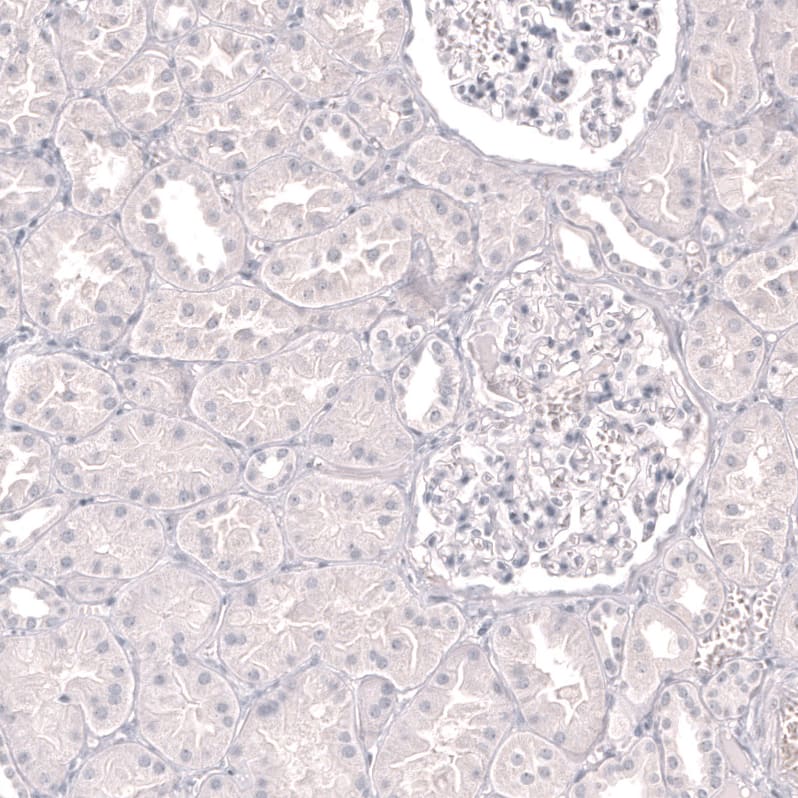 Staining of human kidney shows no positivity in cells in tubules and glomeruli as expected.