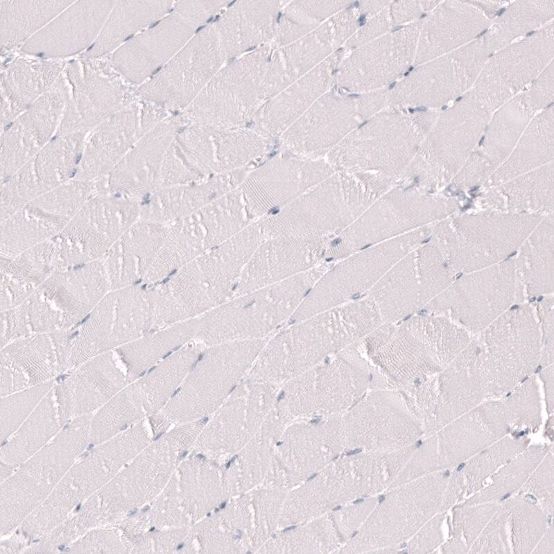 Staining of human skeletal muscle shows no positivity in myocytes as expected.