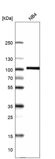 Analysis in human cell line NB4.