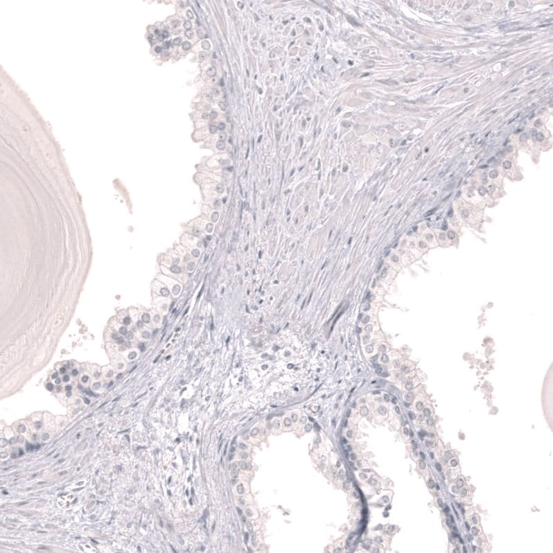 Staining of human prostate shows no positivity in glandular cells as expected.
