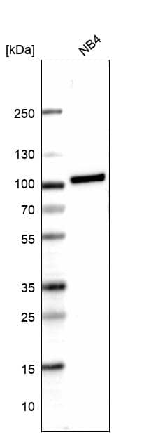 Analysis in human cell line NB4.