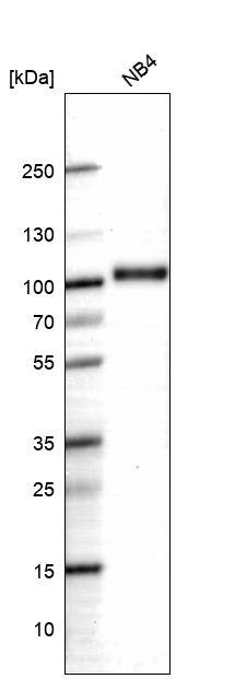 Analysis in human cell line NB4.