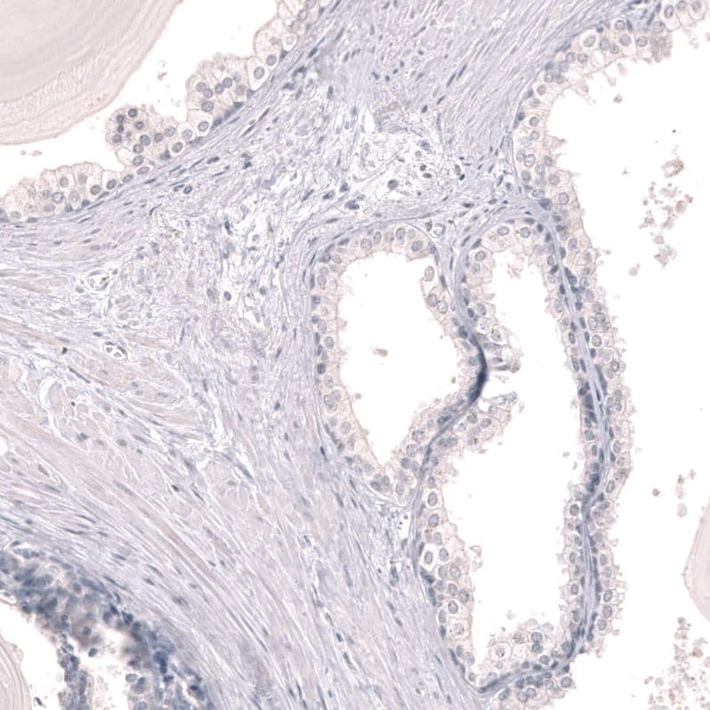Staining of human prostate shows no positivity in glandular cells as expected.