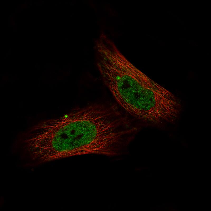 Staining of U-251 MG cells using the Anti-c-jun monoclonal antibody) . 